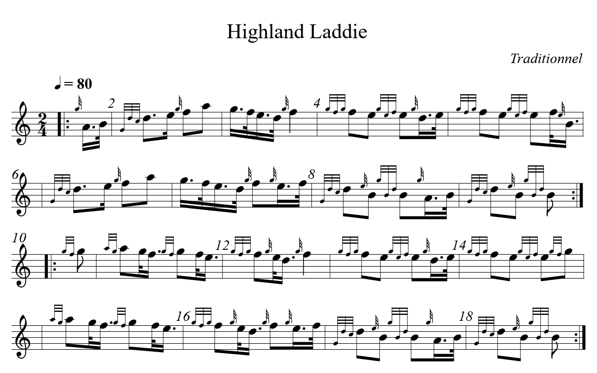 Highland Laddie par Julien